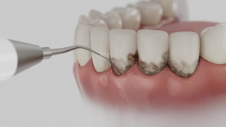 Reliable Dental Implants contractor in Rolling Meadows, IL by Smile Center Dentistry